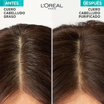 Shampoo Elvive Pure Ácido Hialurónico X 370 Ml - Imagen 3